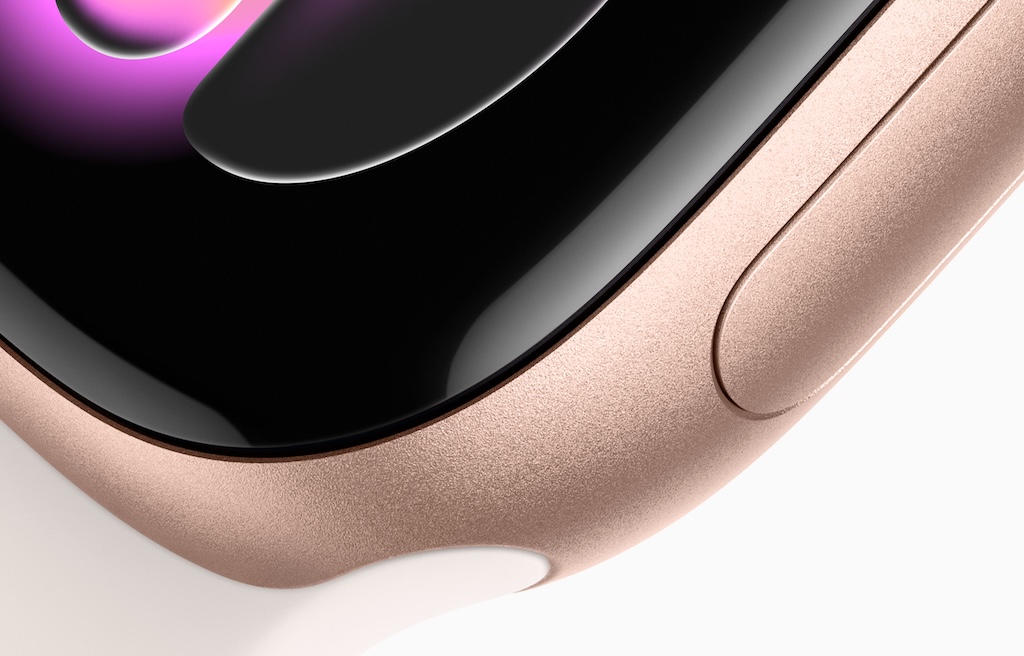 apple watch series 11 detail hlinik